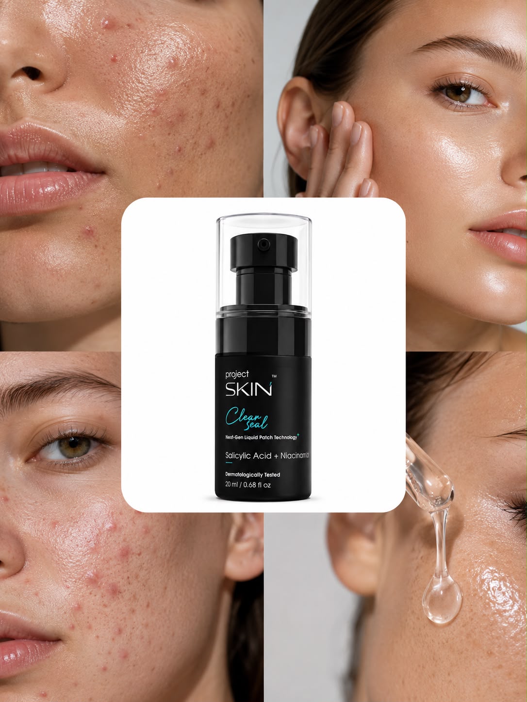 Clear Seal Next-Gen Liquid Patch Technology - Acne Prone Skin